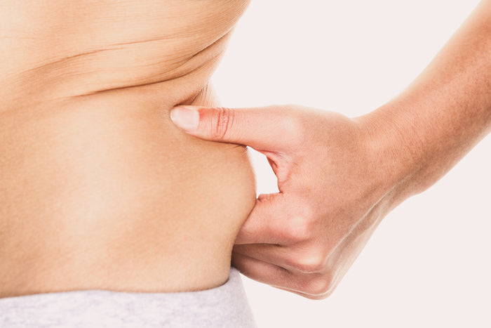 Coolsculpting Elite Flanks (Love Handles)