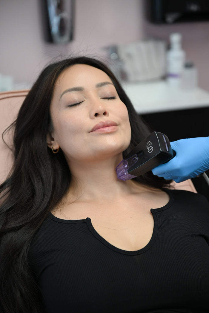 MORPHEUS8 (Face OR Neck)